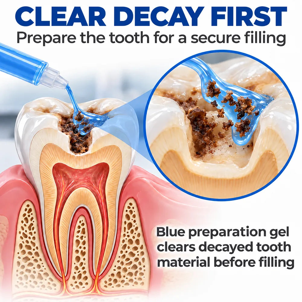 Dr.Fachmer® DentRestore Tooth Repair & Filling System