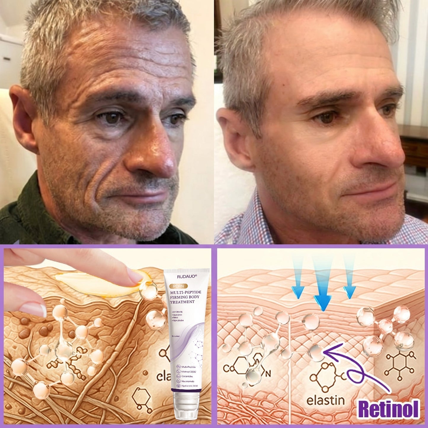 𝓡𝐔𝓓𝐀𝐔𝐎® 🚲️ 𝐏D𝐑N 𝐌u𝐥t𝐢-P𝐞p𝐭i𝐝e 𝐅i𝐫m𝐢n𝐠 𝐁o𝐝y 𝐓r𝐞a𝐭m𝐞n𝐭 - 𝐀n𝐭i-𝐀g𝐢n𝐠, 𝐇y𝐝r𝐚t𝐢n𝐠, 𝐒k𝐢n 𝐅i𝐫m𝐢n𝐠 & 𝐋i𝐟t𝐢n𝐠, 𝐒k𝐢n 𝐑e𝐩a𝐢r, 𝐄v𝐞n 𝐓o𝐧e, 𝐀c𝐧e 𝐚n𝐝 𝐃a𝐫k 𝐒p𝐨t 𝐓r𝐞a𝐭m𝐞n𝐭, 𝐖a𝐫t 𝐚n𝐝 𝐌o𝐥e 𝐑e𝐦o𝐯a𝐥, 𝐚n𝐝 𝐏s𝐨r𝐢a𝐬i𝐬 𝐑e𝐥i𝐞f