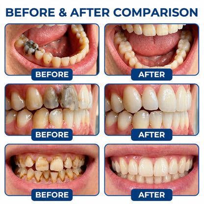 Dr.Fachmer® DentRestore Tooth Repair & Filling System